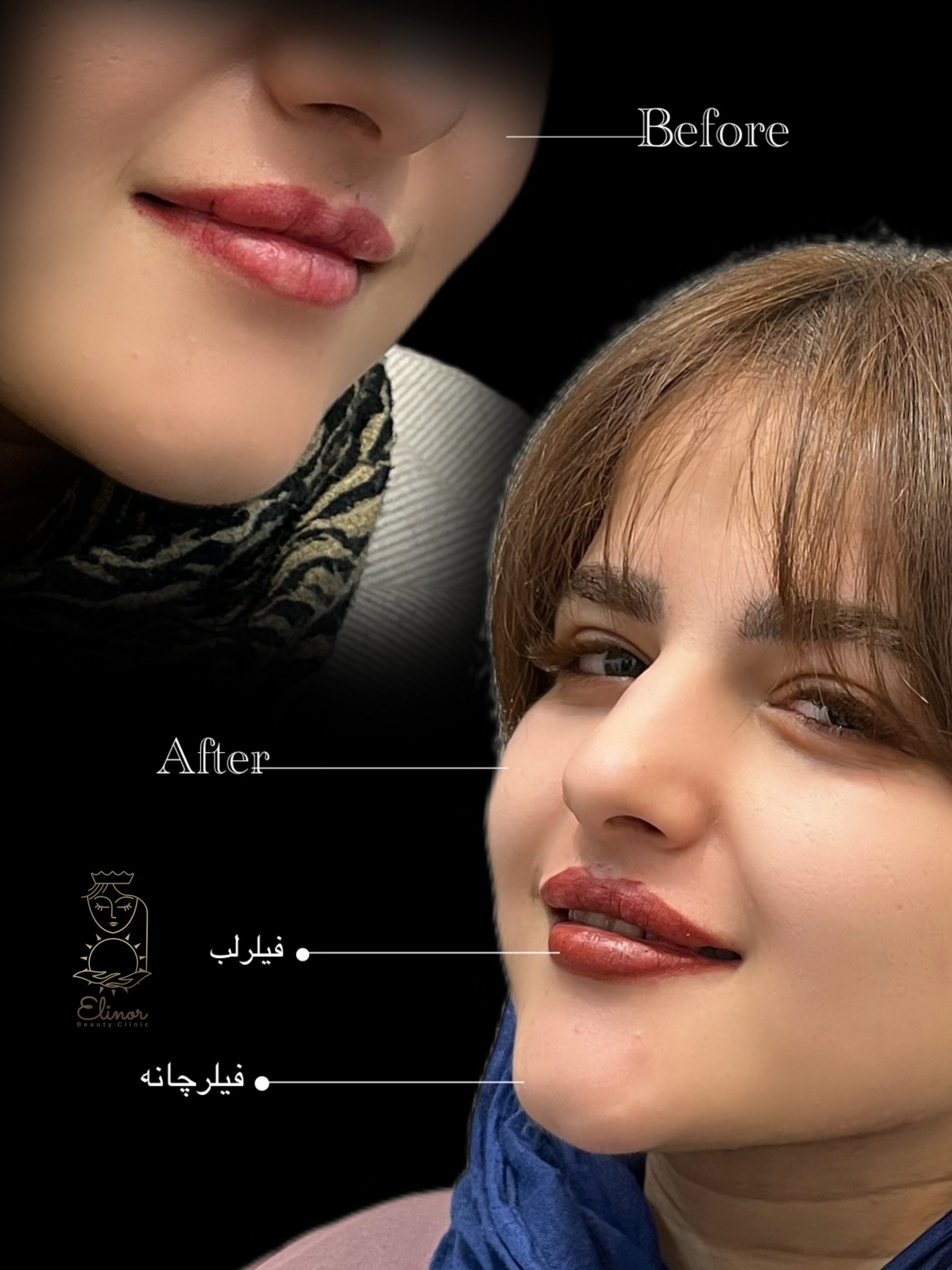 photo output 3 scaled